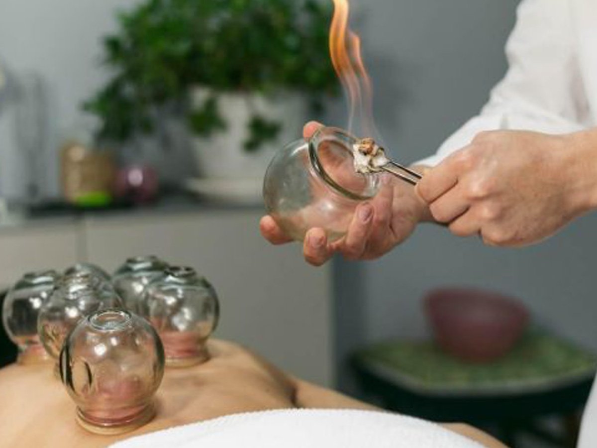 Ateşli kupa terapisi faydaları