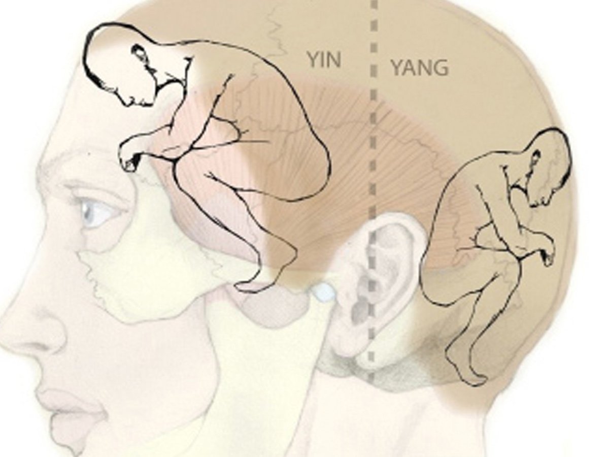 YNSA Kafa Akupunkturunun Başlıca Faydaları