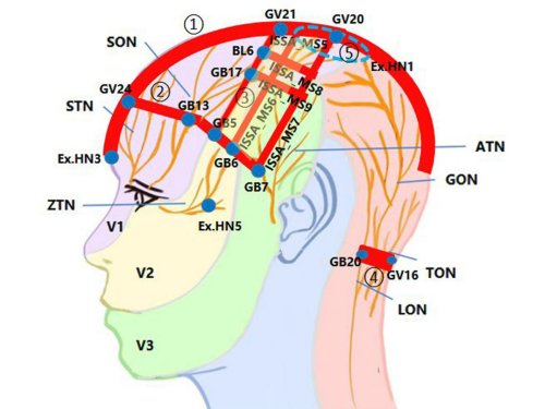 YNSA Kafa Akupunkturunun Başlıca Faydaları